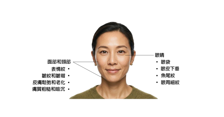 臉部施打範圍_去背